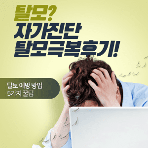 탈모 자가진단, 탈모극복후기